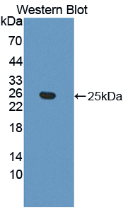 Polyclonal Antibody to Ephrin A5 (EFNA5)