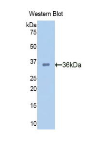 Polyclonal Antibody to Proprotein Convertase Subtilisin/Kexin Type 9 (PCSK9)