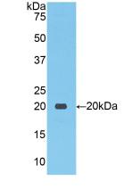 Polyclonal Antibody to Na-Cl Cotransporter (NCCT)