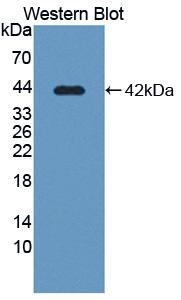Polyclonal Antibody to Solute Carrier Family 39, Member 6 (SLC39A6)