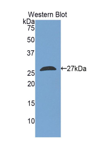 Polyclonal Antibody to Tafazzin (TAZ)