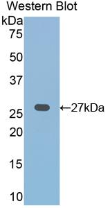Polyclonal Antibody to Frizzled Homolog 1 (FZD1)