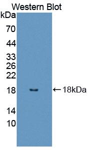Polyclonal Antibody to Ubiquitin A 52 Residue Ribosomal Protein Fusion Product 1 (UBA52)
