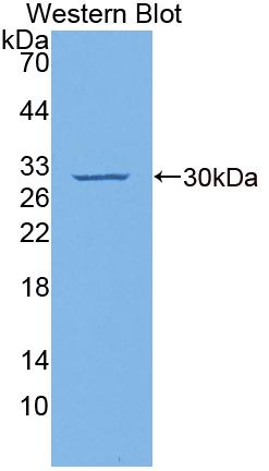 Polyclonal Antibody to Cyclin Dependent Kinase Inhibitor 1B (CDKN1B)