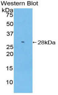 Polyclonal Antibody to Receptor Interacting Serine Threonine Kinase 3 (RIPK3)