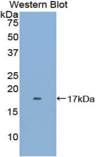 Polyclonal Antibody to FK506 Binding Protein 1B (FKBP1B)