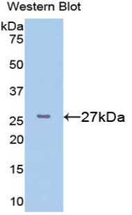 Polyclonal Antibody to FK506 Binding Protein 3 (FKBP3)