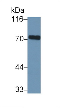 Polyclonal Antibody to Interleukin 23 Receptor (IL23R)