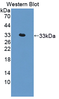 Polyclonal Antibody to Interleukin 22 Receptor (IL22R)