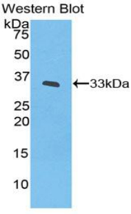 Polyclonal Antibody to Interleukin 20 Receptor Beta (IL20Rb)
