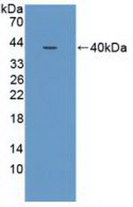 Polyclonal Antibody to Nuclear Receptor Coactivator 3 (NCOA3)