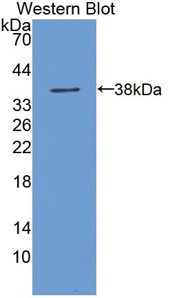 Polyclonal Antibody to Aldehyde Dehydrogenase 3 Family, Member A1 (ALDH3A1)
