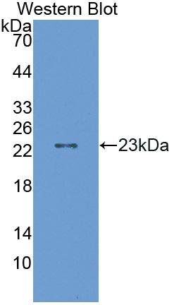 Polyclonal Antibody to Aldehyde Dehydrogenase 9 Family, Member A1 (ALDH9A1)