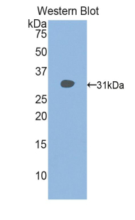 Polyclonal Antibody to Histone Deacetylase 6 (HDAC6)