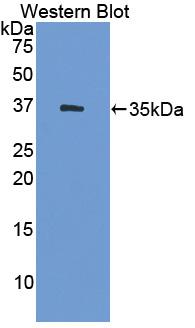 Polyclonal Antibody to 17-Beta-Hydroxysteroid Dehydrogenase Type 1 (HSD17b1)
