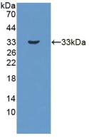 Polyclonal Antibody to 17-Beta-Hydroxysteroid Dehydrogenase Type 3 (HSD17b3)