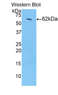 Polyclonal Antibody to 17-Beta-Hydroxysteroid Dehydrogenase Type 12 (HSD17b12)