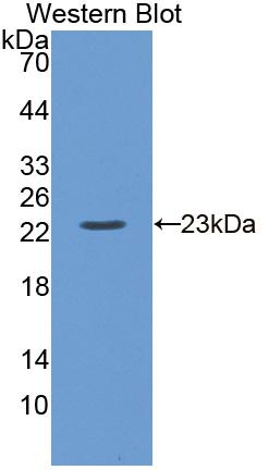 Polyclonal Antibody to Calcium Channel, Voltage Dependent, L-Type, Alpha 1S Subunit (CACNa1S)