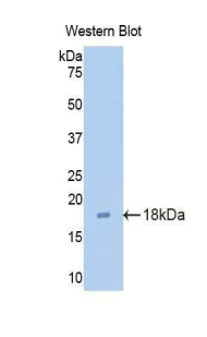 Polyclonal Antibody to Claudin 3 (CLDN3)