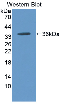 Polyclonal Antibody to Carboxypeptidase N2 (CPN2)