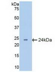 Polyclonal Antibody to Crystallin Beta B2 (CRYbB2)