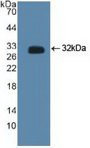 Polyclonal Antibody to C-Terminal Binding Protein 2 (CTBP2)