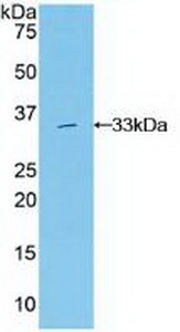 Polyclonal Antibody to Growth Factor Receptor Bound Protein 7 (Grb7)