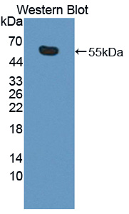 Polyclonal Antibody to Kinesin Family, Member 18A (KIF18A)