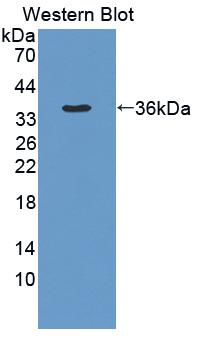 Polyclonal Antibody to Peptidyl Arginine Deiminase Type IV (PADI4)