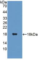 Polyclonal Antibody to Pantothenate Kinase 4 (PANK4)