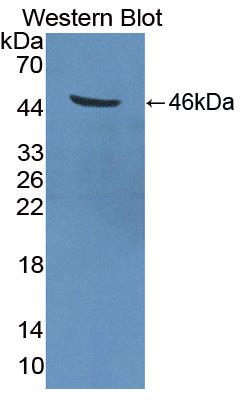 Polyclonal Antibody to Transmembrane Protease, Serine 4 (TMPRSS4)