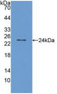 Polyclonal Antibody to Transient Receptor Potential Cation Channel Subfamily V, Member 1 (TRPV1)