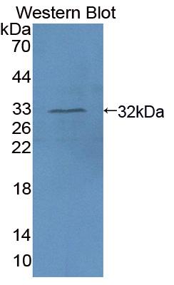 Polyclonal Antibody to Absent In Melanoma 1 (AIM1)