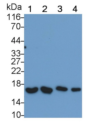 Polyclonal Antibody to ATPase, H+ Transporting, Mitochondrial F1 Complex Delta Polypeptide (ATP5d)