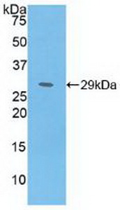 Polyclonal Antibody to Methionine Adenosyltransferase II Alpha (MAT2a)