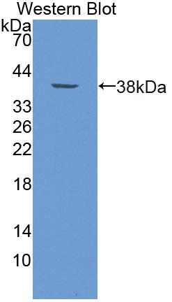 Polyclonal Antibody to Histidine Decarboxylase (HDC)