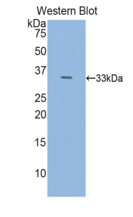 Polyclonal Antibody to Histidine Decarboxylase (HDC)
