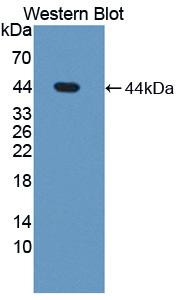 Polyclonal Antibody to Steroid Sulfatase Isozyme S (STS)
