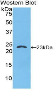 Polyclonal Antibody to Lens Epithelium Derived Growth Factor (LEDGF)