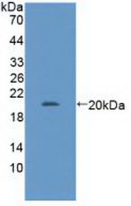 Polyclonal Antibody to GA Binding Protein Transcription Factor Alpha (GABPa)