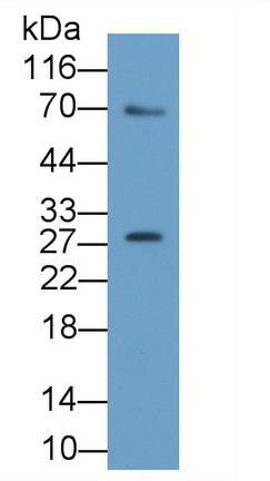 Polyclonal Antibody to Spermidine/Spermine N1-Acetyltransferase 1 (SAT1)