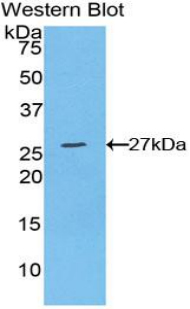 Polyclonal Antibody to WNT1 Inducible Signaling Pathway Protein 2 (WISP2)