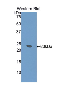 Polyclonal Antibody to Interferon Alpha 7 (IFNa7)