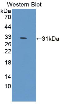 Polyclonal Antibody to Tumor Protein p53 Binding Protein 1 (TP53BP1)