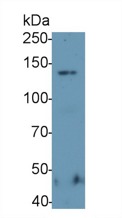 Polyclonal Antibody to Zinc Finger Homeobox Protein 1A (ZFHX1A)