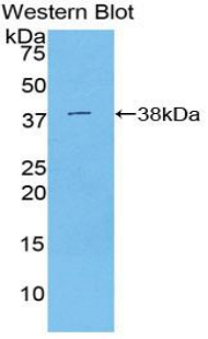 Polyclonal Antibody to Signal Transducing Adaptor Protein 1 (STAP1)