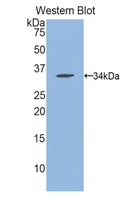 Polyclonal Antibody to N-Methylpurine DNA Glycosylase (MPG)