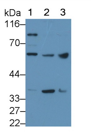 Polyclonal Antibody to Microphthalmia Associated Transcription Factor (MITF)