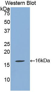 Polyclonal Antibody to Klotho Beta (KLb)