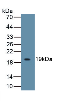 Polyclonal Antibody to Interleukin 18 Binding Protein (IL18BP)